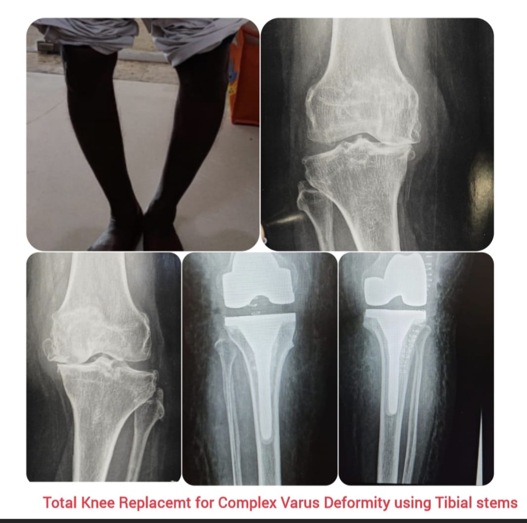 Knee X-ray 5